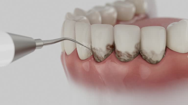 Trusted Dental Crowns And Bridges service in Gotha, FL - Dentist Open Now